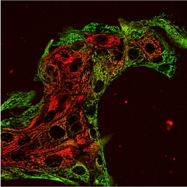 Fig. 6. Staining of MDCK cells with rhodamine 123 (green) and DiIC1(5) (red). Both dyes enter mitochondria, but rhodamine 123 stains the periphery of MDCK colonies, while DiIC1(5) accumulates in the central parts. The heterogeneous staining does not result from competition, as it is also observed using single stains. Most likely, this heterogeneous staining reflects the distribution of yet unidentified channels used for the dye entry. From [25], with permission.
