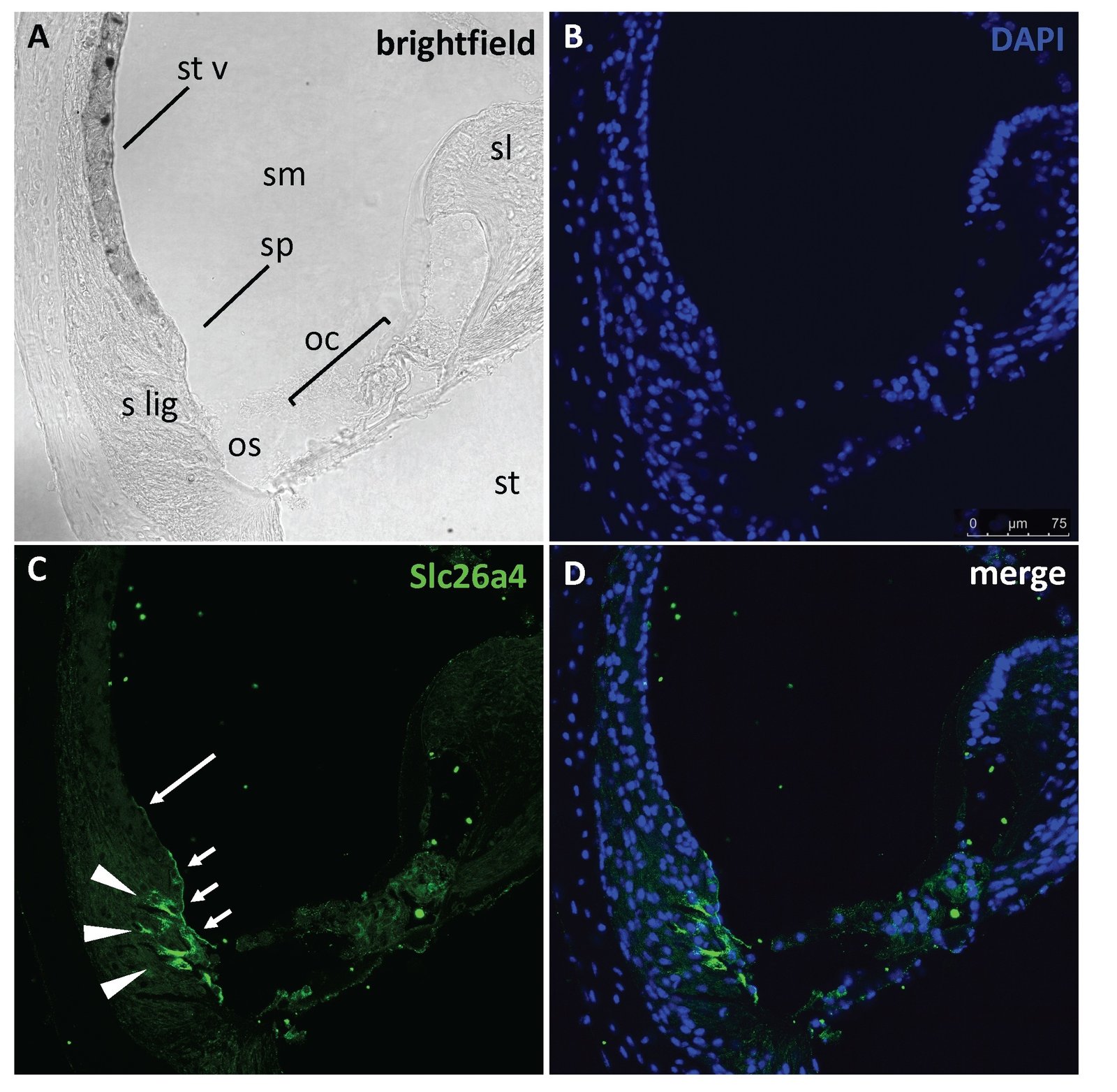 Fig. 2. Immunohistochemistry of the mouse inner ear showing Slc26a4 expression. Cochlear cryo-sections from adult CBA/J mice have been probed with a customized rabbit anti-Slc26a4 antibody [226], counterstained with DAPI, and imaged by confocal microscopy (Leica TCS SP5II AOBS, Leica Microsystems, Wetzlar, Germany, equipped with an HCX PL APO CS 40x/1.25 oil immersion objective). A, brightfield image; B, cell nuclei; C, Slc26a4 signal; and D, merged image. The arrowheads and short arrows in panel C indicate Slc26a4 expression in root cells and epithelial cells of the outer sulcus and spiral prominence, respectively. The long arrow indicates Slc26a4 expression in the spindle-shaped cells within the stria vascularis. Oc, organ of Corti, os, outer sulcus, sl, spiral limbus, s lig, spiral ligament, sm, scala media, sp, spiral prominence, st, scala timpani, st v, stria vascularis.
